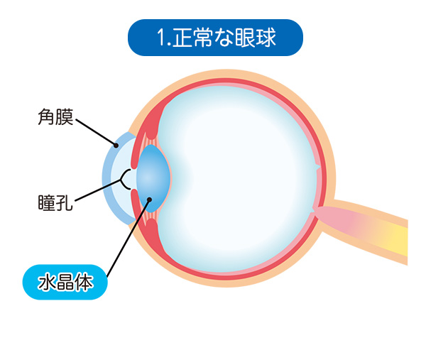 1．通常の眼球
